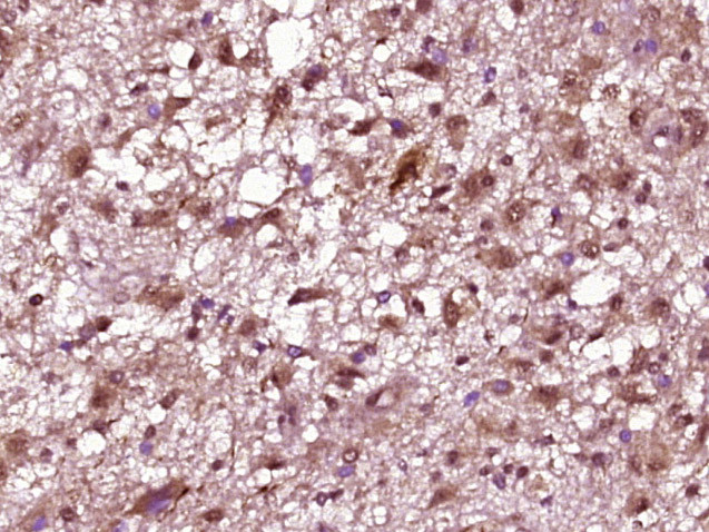 Phospho-NeuroD1 (Ser274) Antibody in Immunohistochemistry (Paraffin) (IHC (P))