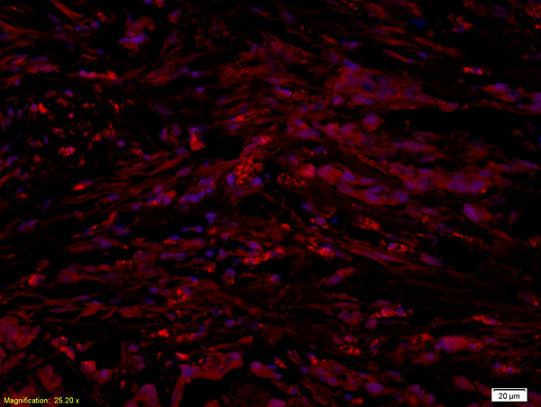 UCP-1 Antibody in Immunohistochemistry (Paraffin) (IHC (P))