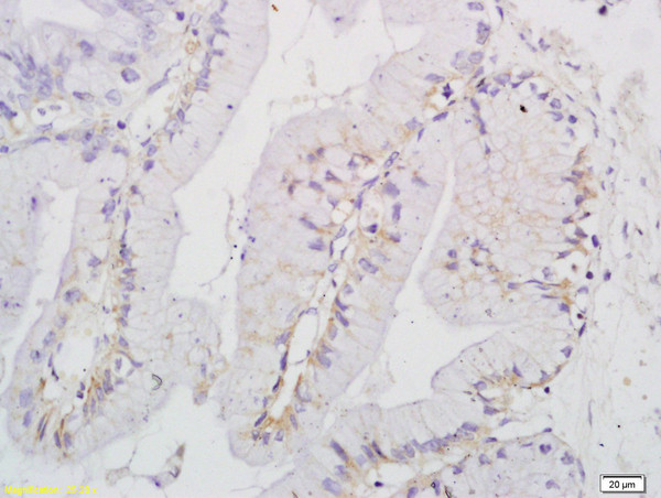 UCP-2 Antibody in Immunohistochemistry (Paraffin) (IHC (P))