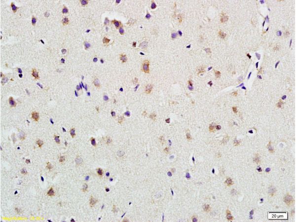 PLAUR Antibody in Immunohistochemistry (Paraffin) (IHC (P))