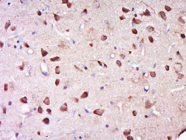 Phospho-nNOS (Ser1417) Antibody in Immunohistochemistry (Paraffin) (IHC (P))