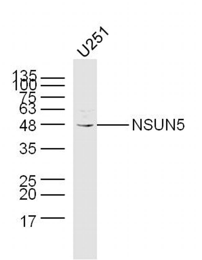 NSUN5 Antibody in Western Blot (WB)