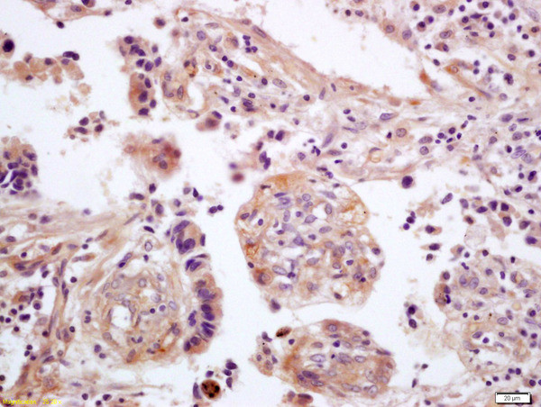 WNT5A Antibody in Immunohistochemistry (Paraffin) (IHC (P))