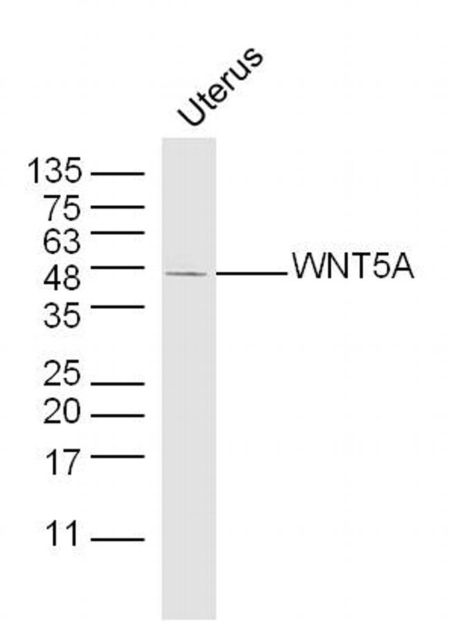 WNT5A Antibody in Western Blot (WB)