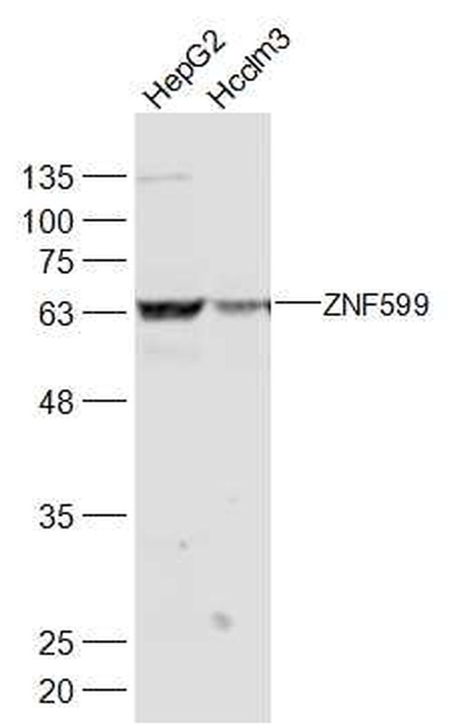 ZNF599 Antibody in Western Blot (WB)