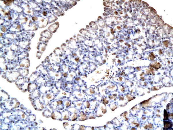 BSEP/ABCB11 Antibody in Immunohistochemistry (Paraffin) (IHC (P))