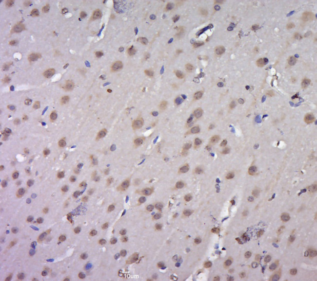 VEGF-A Antibody in Immunohistochemistry (Paraffin) (IHC (P))