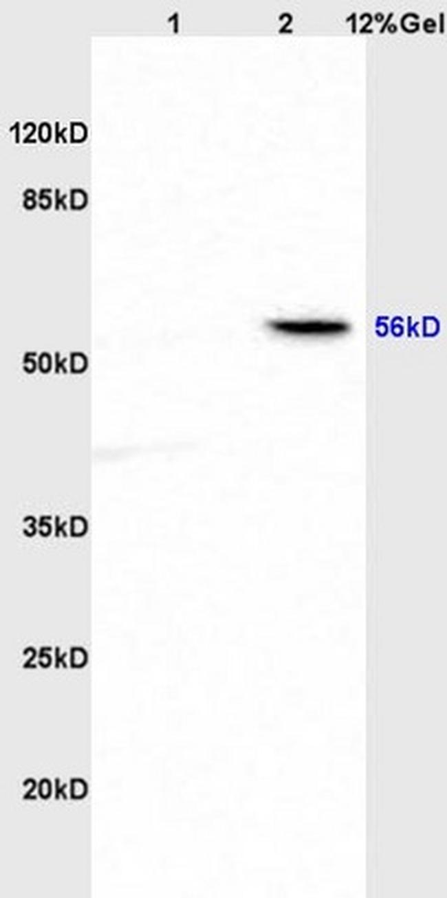 ABI1 Antibody in Western Blot (WB)