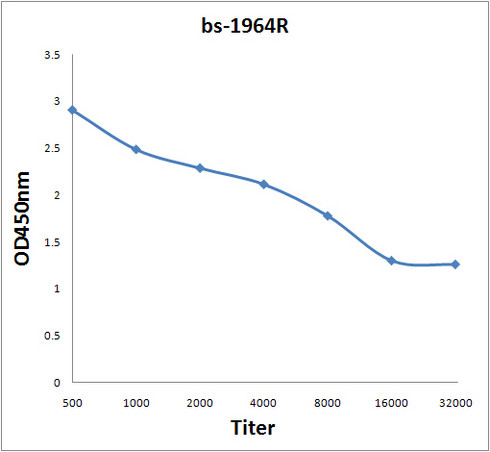 KLK3 Antibody in ELISA (ELISA)