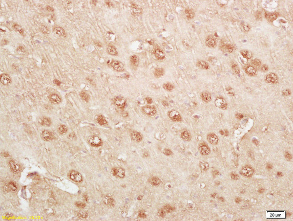 Kallikrein 14 Antibody in Immunohistochemistry (Paraffin) (IHC (P))