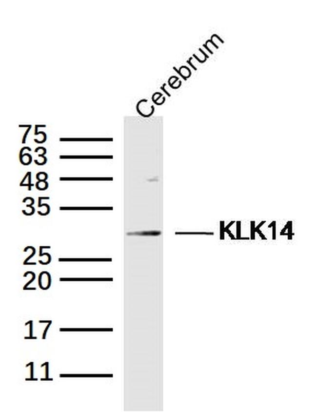 Kallikrein 14 Antibody in Western Blot (WB)