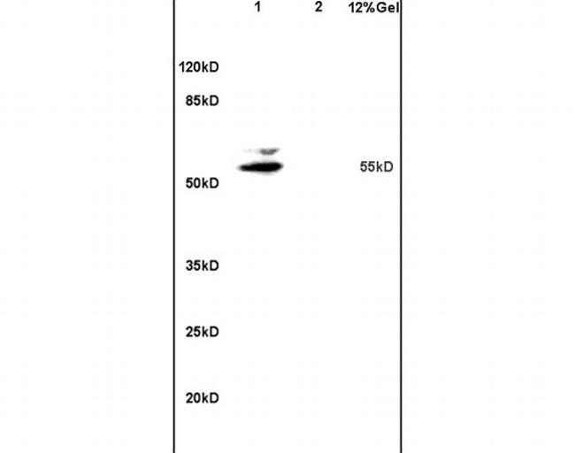 Matrilin 1 Antibody in Western Blot (WB)