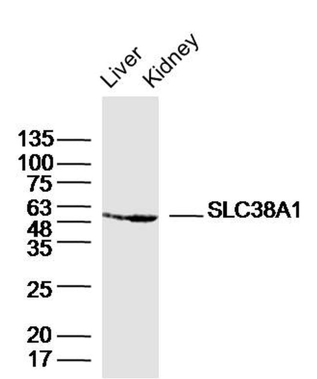 SLC38A1 Antibody in Western Blot (WB)