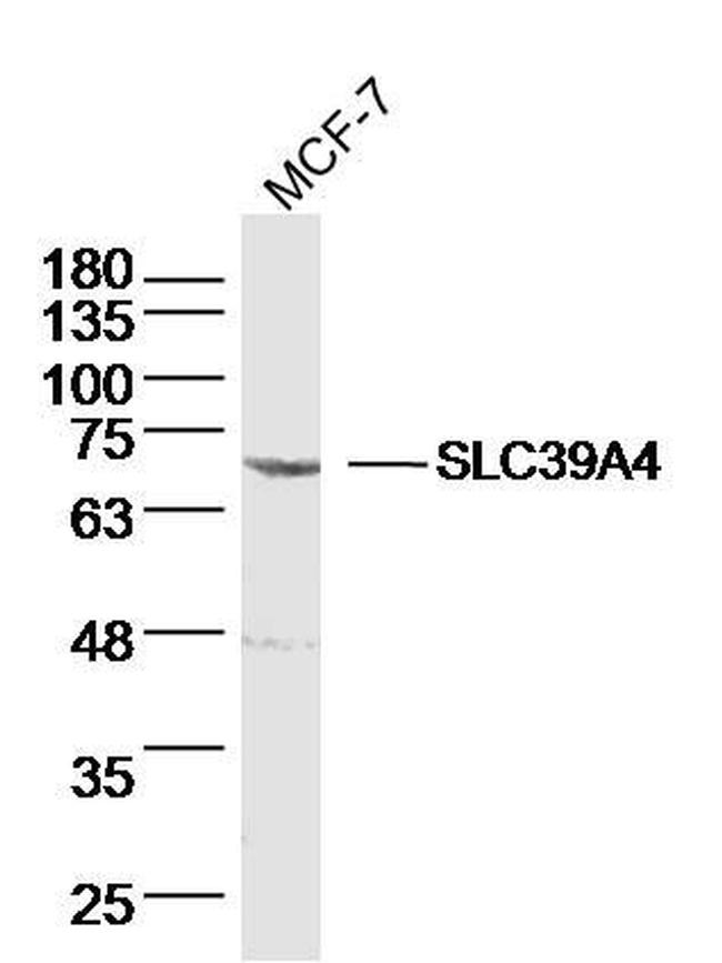 SLC39A4 Antibody in Western Blot (WB)