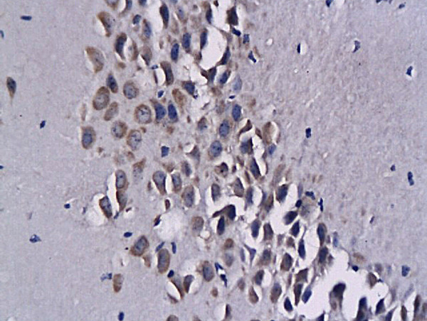 MCP-3/CCL7 Antibody in Immunohistochemistry (Paraffin) (IHC (P))