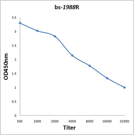 Menin Antibody in ELISA (ELISA)