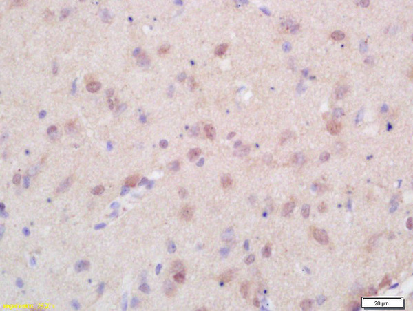 Menin Antibody in Immunohistochemistry (Paraffin) (IHC (P))