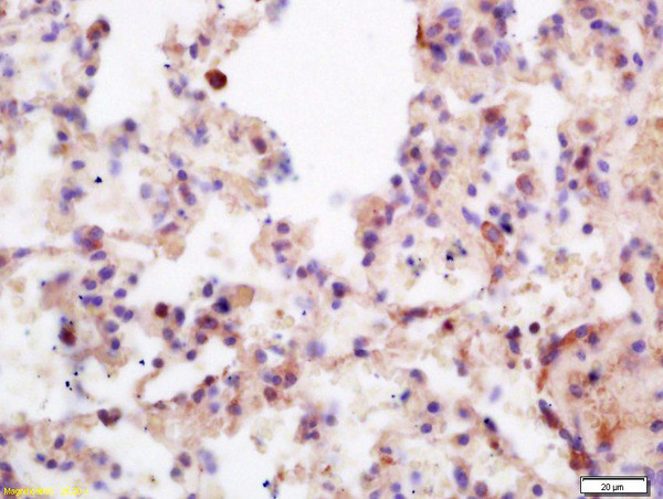 Menin Antibody in Immunohistochemistry (Paraffin) (IHC (P))