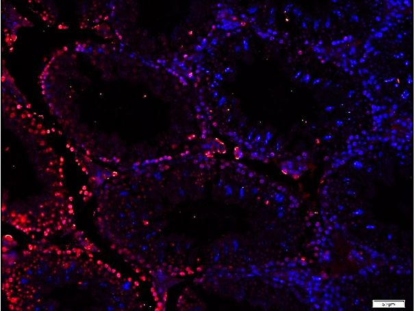 Phospho-Src (Ser75) Antibody in Immunohistochemistry (Paraffin) (IHC (P))