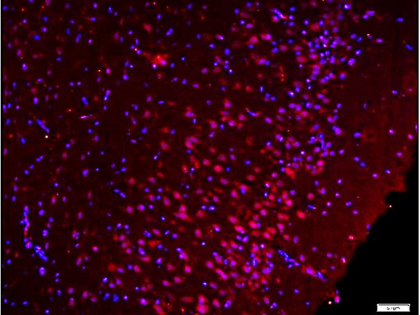 Phospho-Src (Ser75) Antibody in Immunohistochemistry (Paraffin) (IHC (P))