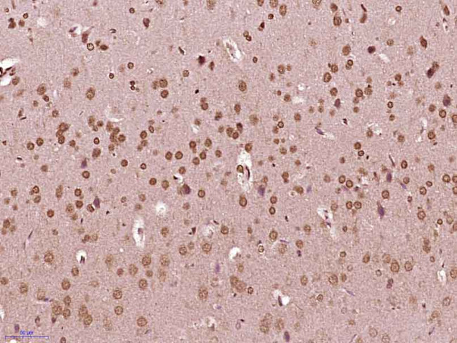 Phospho-Src (Ser75) Antibody in Immunohistochemistry (Paraffin) (IHC (P))