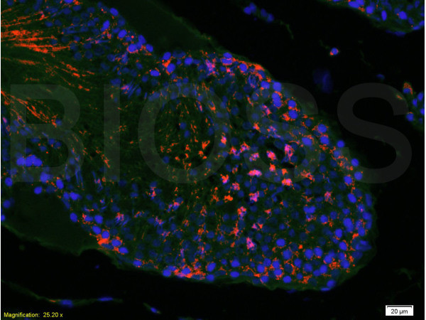 mTOR/FRAP Antibody in Immunohistochemistry (Paraffin) (IHC (P))