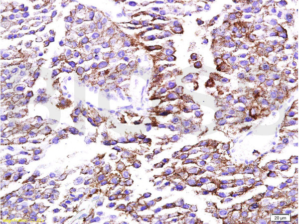 mTOR/FRAP Antibody in Immunohistochemistry (Paraffin) (IHC (P))