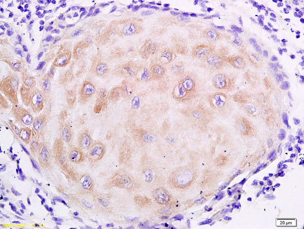 Mucin 4 Antibody in Immunohistochemistry (Paraffin) (IHC (P))