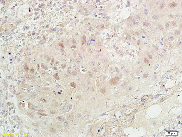 PCNA-proliferation Marker Antibody in Immunohistochemistry (Paraffin) (IHC (P))