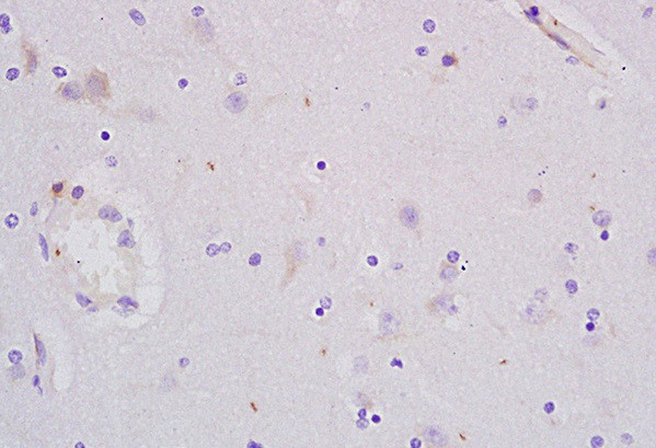 PCNA-proliferation Marker Antibody in Immunohistochemistry (Paraffin) (IHC (P))