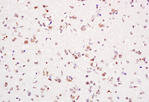 PCNA-proliferation Marker Antibody in Immunohistochemistry (Paraffin) (IHC (P))