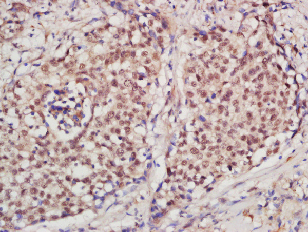 PCNA [proliferation Marker] Antibody in Immunohistochemistry (Paraffin) (IHC (P))