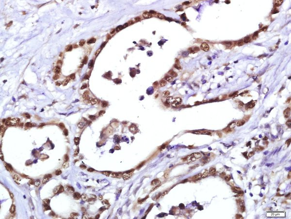 PCNA [proliferation Marker] Antibody in Immunohistochemistry (Paraffin) (IHC (P))