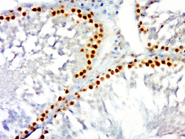 PCNA [proliferation Marker] Antibody in Immunohistochemistry (Paraffin) (IHC (P))