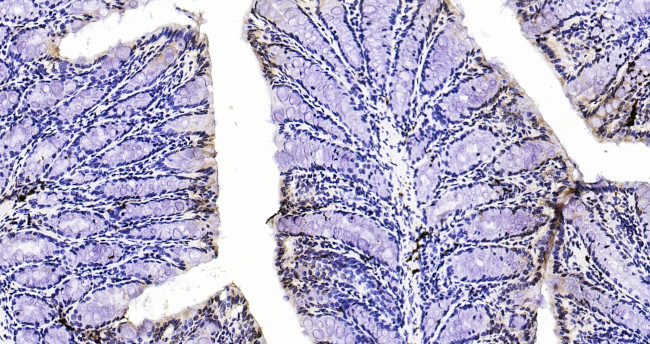 Phospho-FoxO1 (Ser319) Antibody in Immunohistochemistry (Paraffin) (IHC (P))