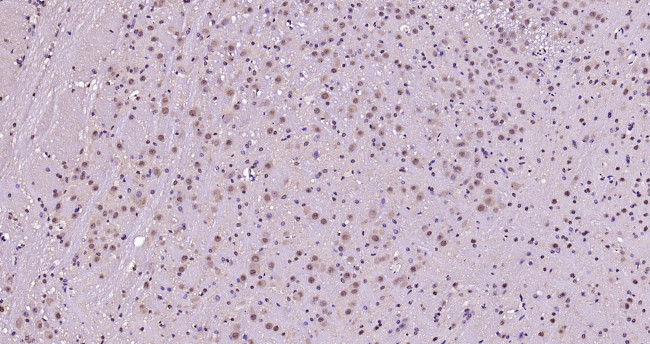 Phospho-FoxO1 (Ser319) Antibody in Immunohistochemistry (Paraffin) (IHC (P))