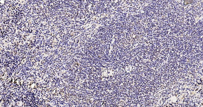 Phospho-FoxO1 (Ser319) Antibody in Immunohistochemistry (Paraffin) (IHC (P))