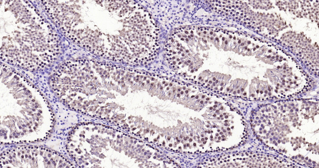 Phospho-FoxO1 (Ser319) Antibody in Immunohistochemistry (Paraffin) (IHC (P))