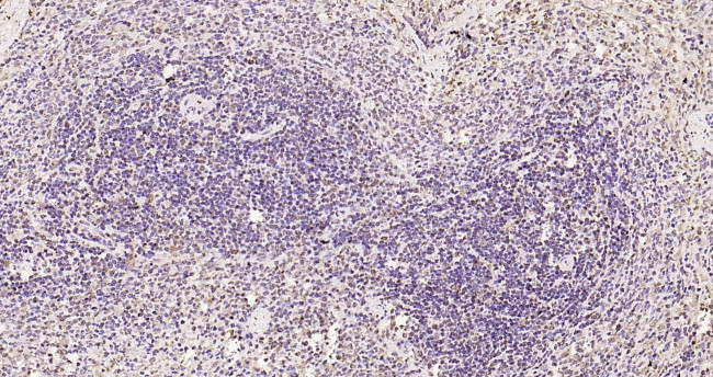 Phospho-FoxO1 (Ser319) Antibody in Immunohistochemistry (Paraffin) (IHC (P))