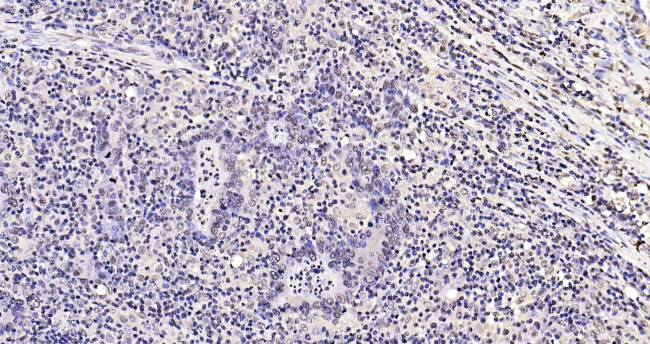 Phospho-FoxO1 (Ser319) Antibody in Immunohistochemistry (Paraffin) (IHC (P))