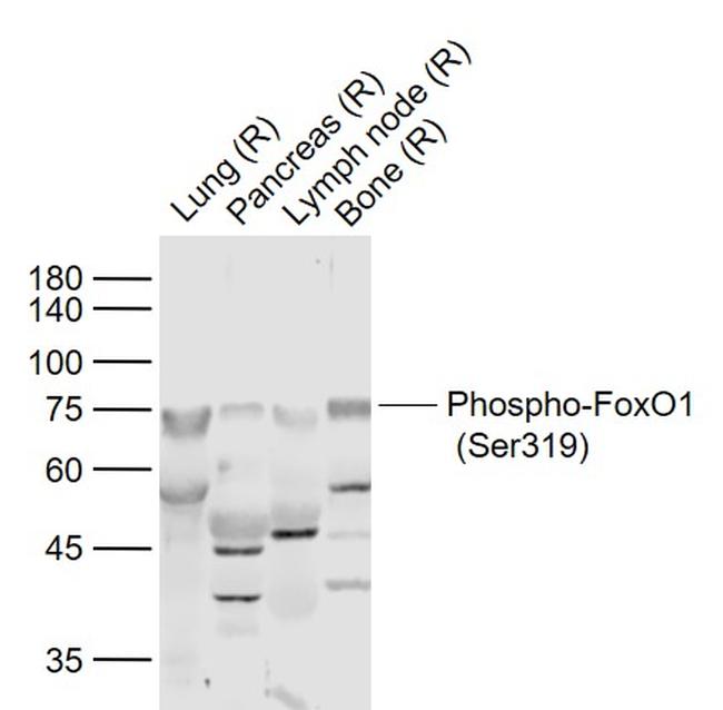 Phospho-FoxO1 (Ser319) Antibody in Western Blot (WB)