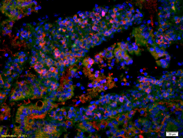 EGF Antibody in Immunohistochemistry (Paraffin) (IHC (P))