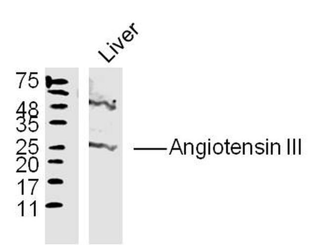 Angiotensin 3 Antibody in Western Blot (WB)