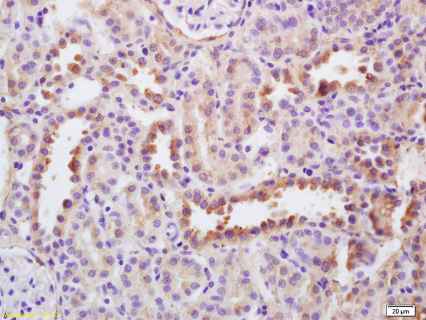 EGF Antibody in Immunohistochemistry (Paraffin) (IHC (P))