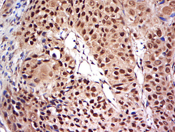 NFKB p65 Antibody in Immunohistochemistry (Paraffin) (IHC (P))