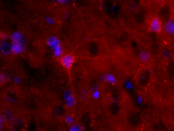 S100B Antibody in Immunohistochemistry (Paraffin) (IHC (P))