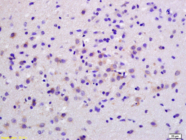 S100B Antibody in Immunohistochemistry (Paraffin) (IHC (P))