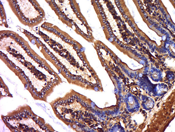 HSD11B2 Antibody in Immunohistochemistry (Paraffin) (IHC (P))