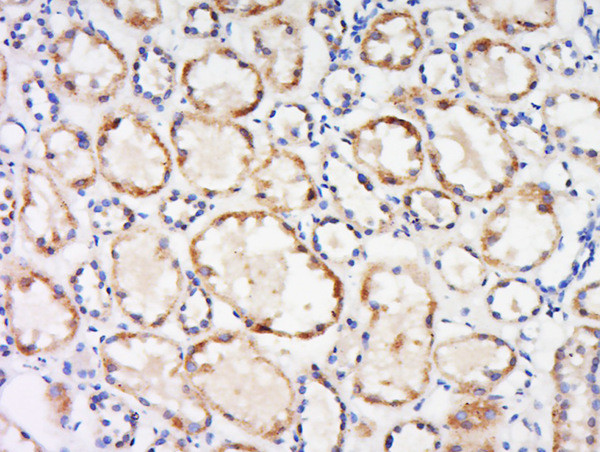 Dematin Antibody in Immunohistochemistry (Paraffin) (IHC (P))