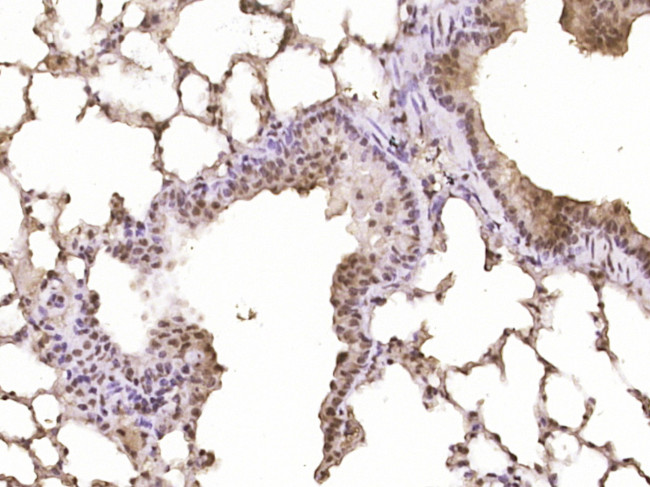 Neurogenic locus notch homolog protein 1 Antibody in Immunohistochemistry (Paraffin) (IHC (P))